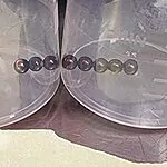 הרופאים נדהמו: זה מה שגרם לילד כאבים