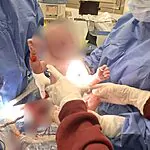 "זו התשובה לאויבים שלנו": ניתוח קיסרי ראשון בוצע בזמן אזעקה